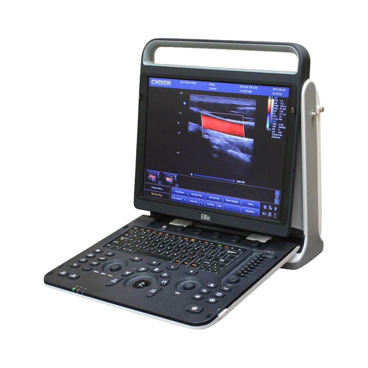 Портативный УЗИ аппарат Chison SonoTouch 60