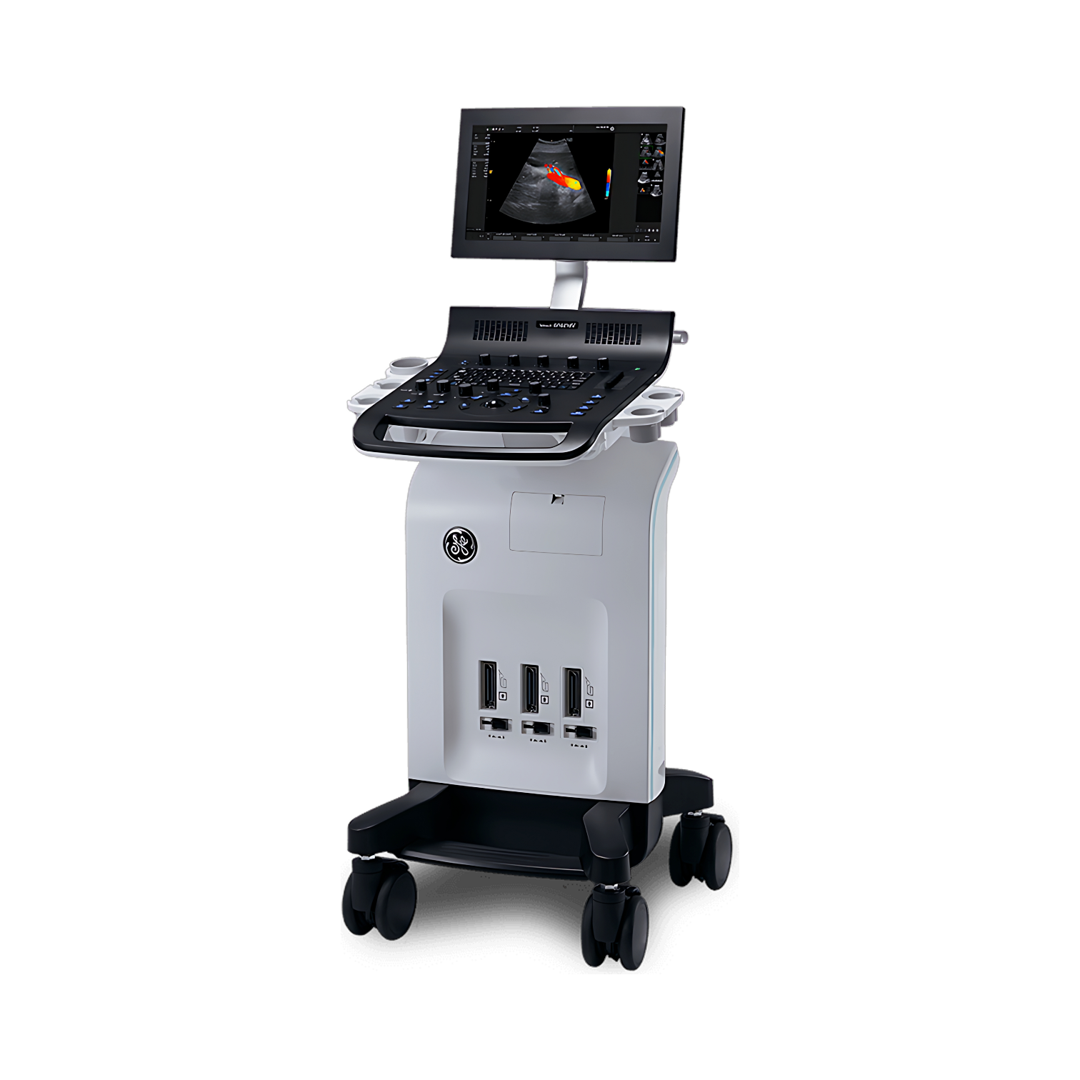 Ультразвуковая система GE Versana Essential