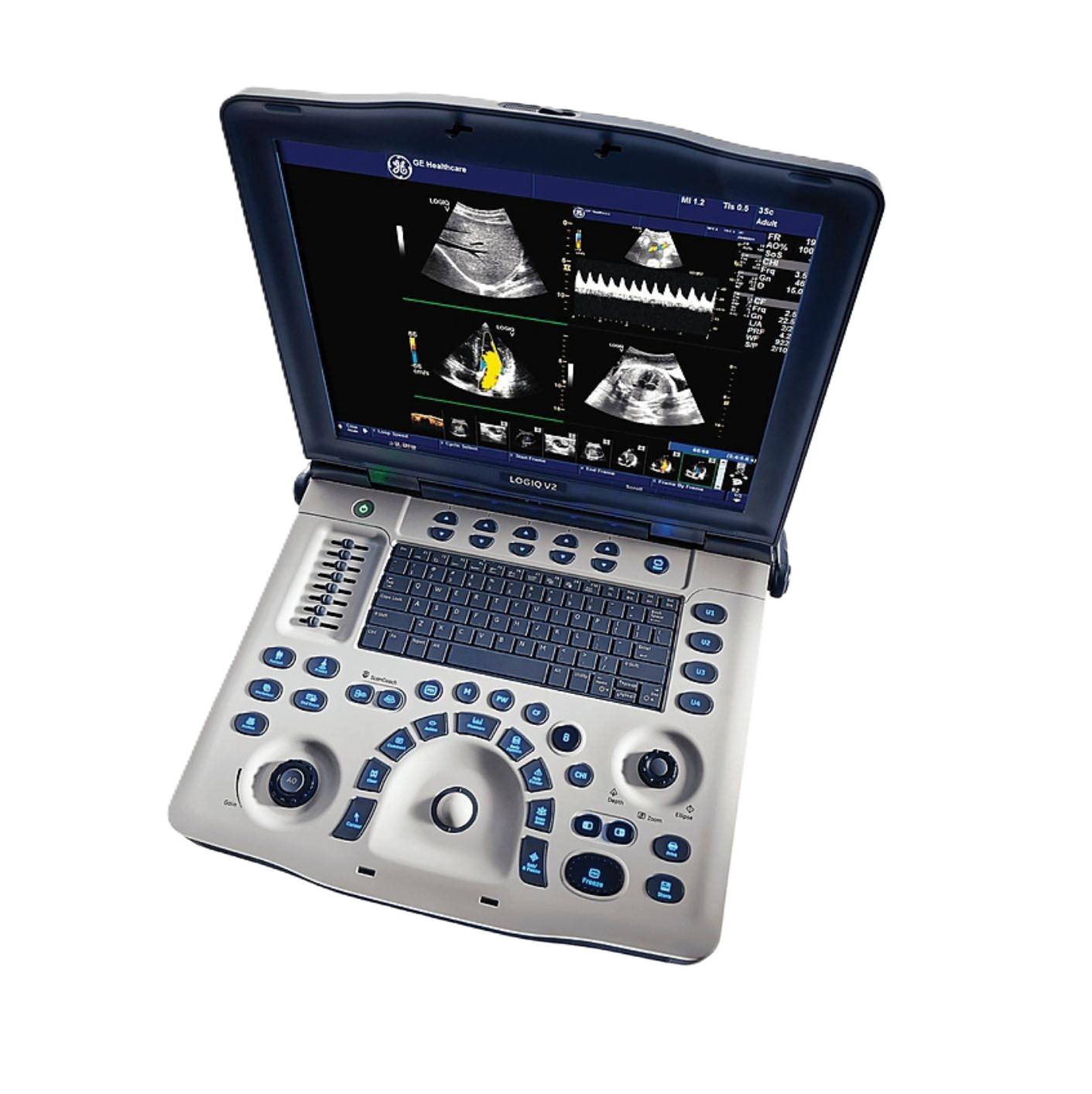 Ультразвуковая диагностическая система GE Healthcare LOGIQ V2