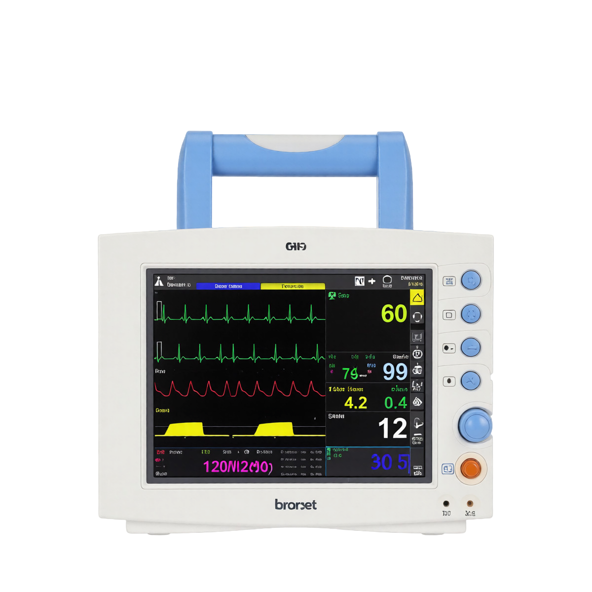 Монитор пациента Bionet BM3
