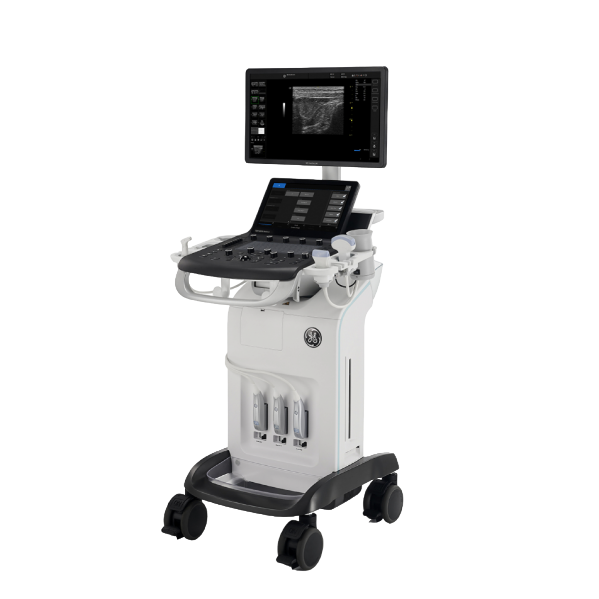 УЗИ аппарат CHISON Qbit 10 New Matrix