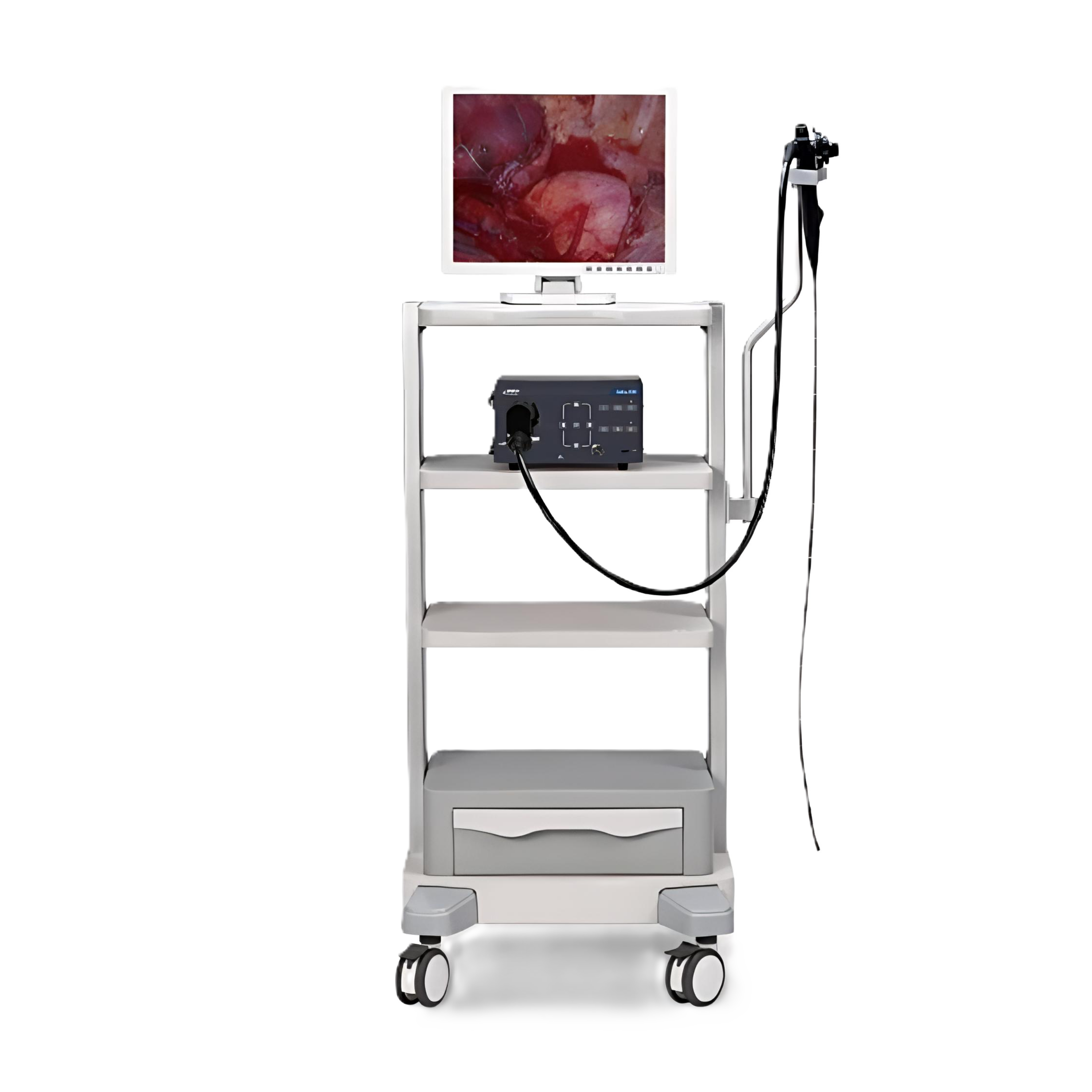 Видеоэндоскопическая система Mindray Vetina ES3