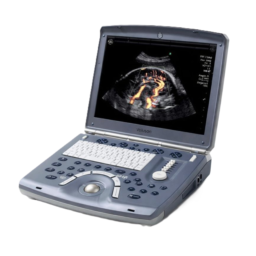 УЗИ аппарат GE Healthcare Voluson E