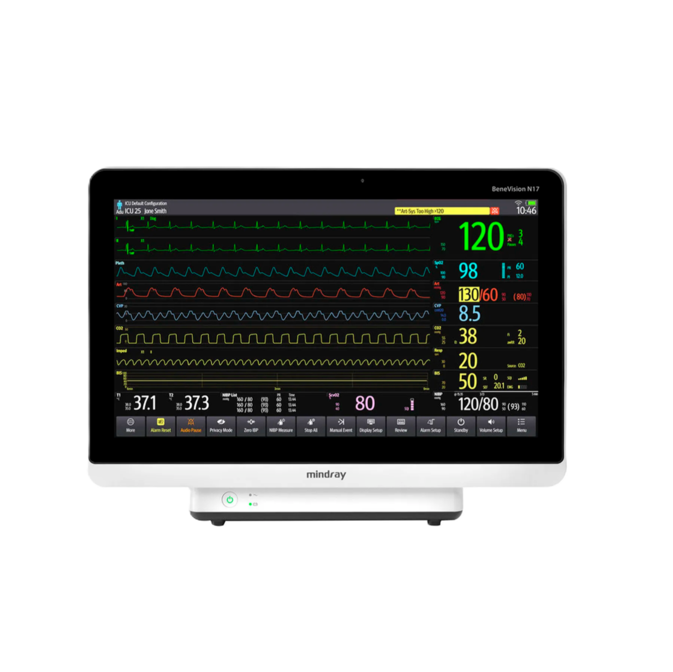 Монитор пациента Mindray BeneVision N17