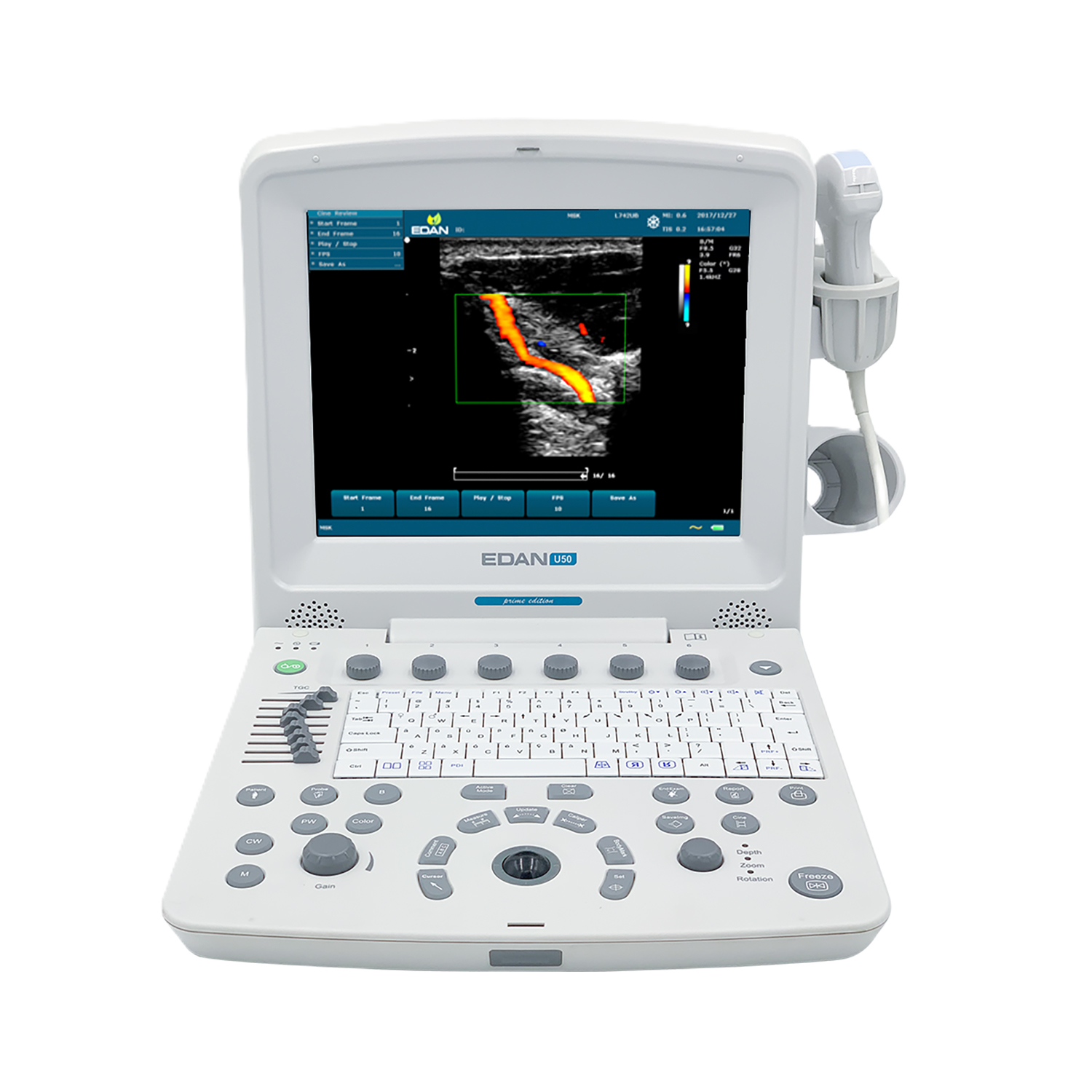 УЗИ аппарат Edan U50 Prime Edition