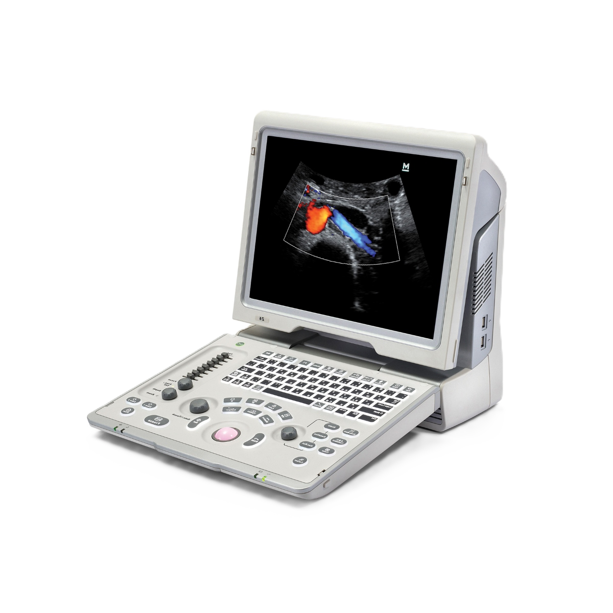 УЗИ аппарат Mindray Z6