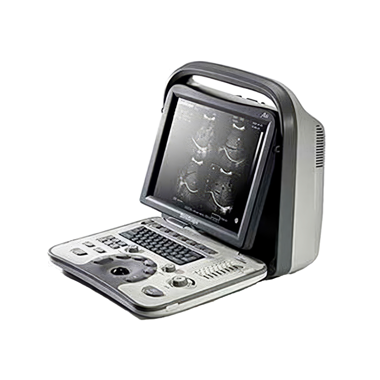 Ультразвуковой аппарат SonoScape A6