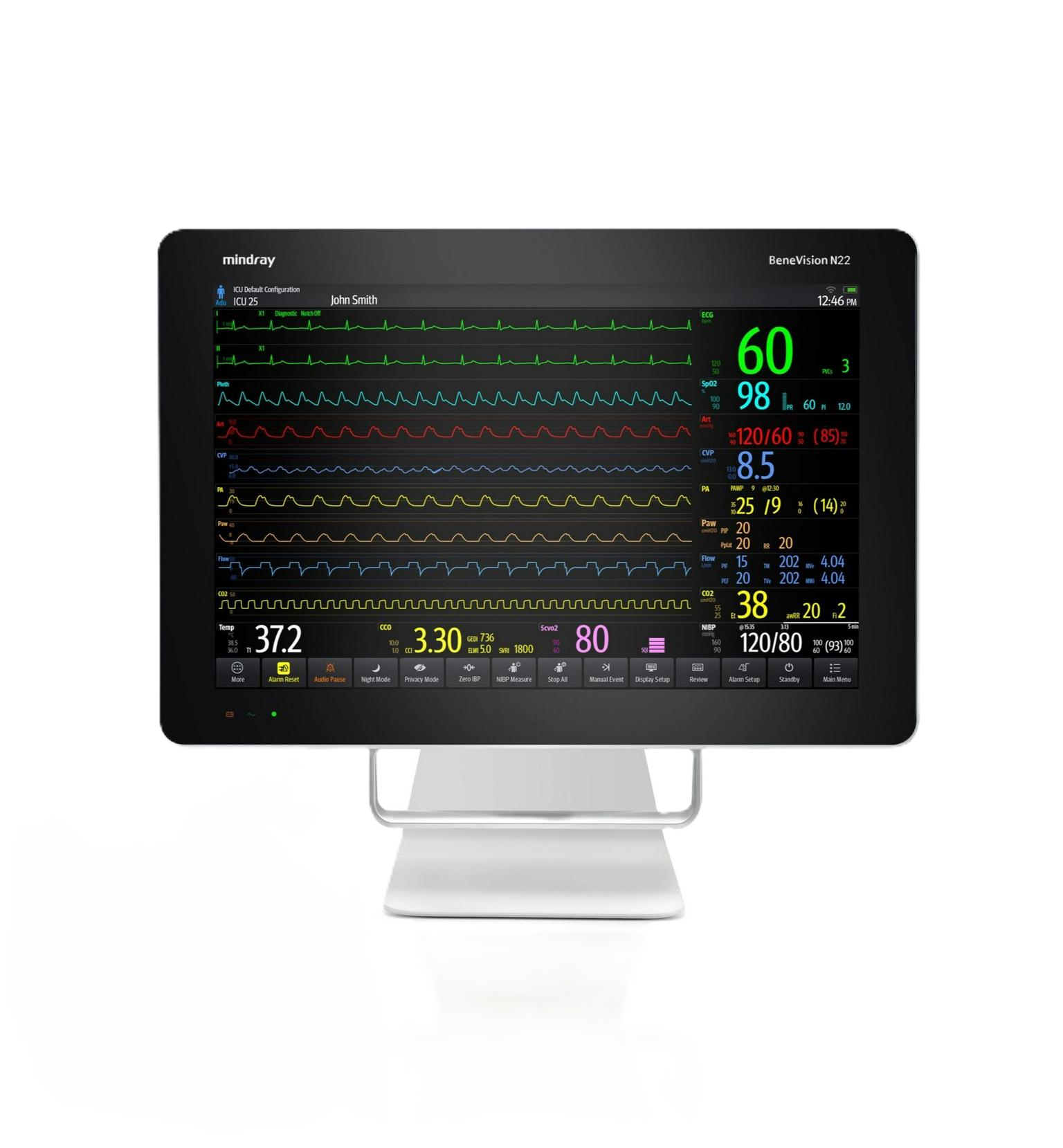 Монитор пациента Mindray BeneVision N22