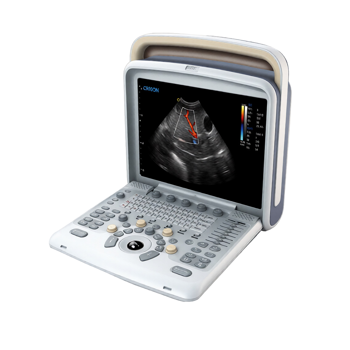 УЗИ аппарат Chison SonoTouch 50