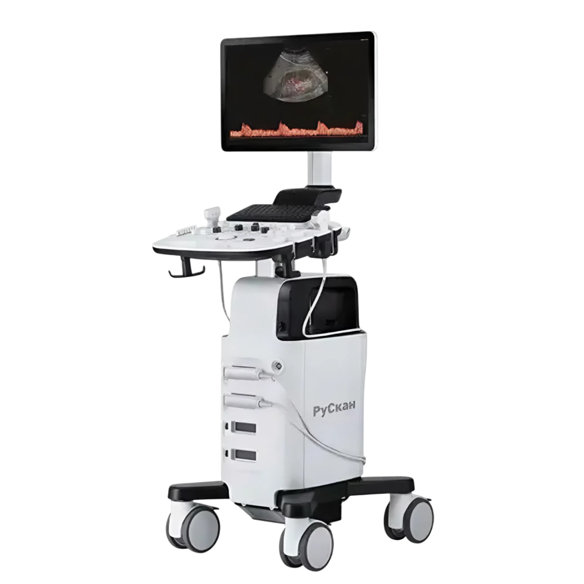 УЗИ аппарат РуСкан 50