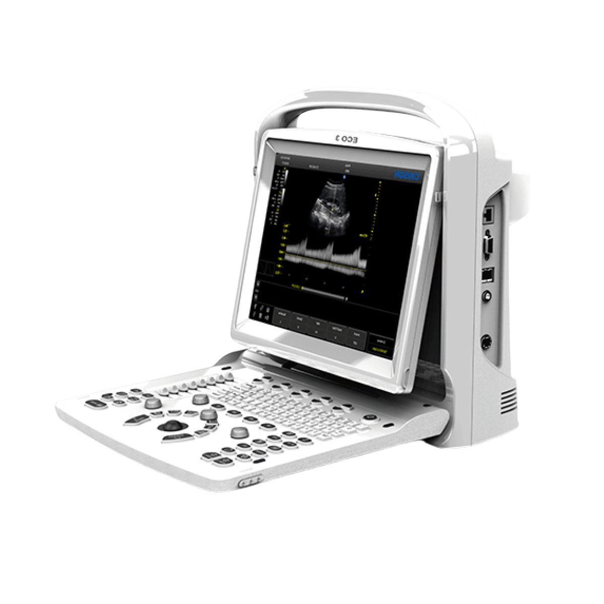 УЗИ аппарат CHISON ECO 3 Expert