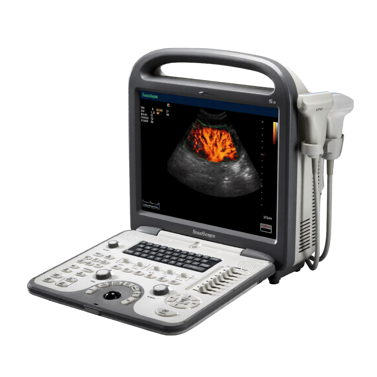 Ультразвуковой аппарат SonoScape S6Pro