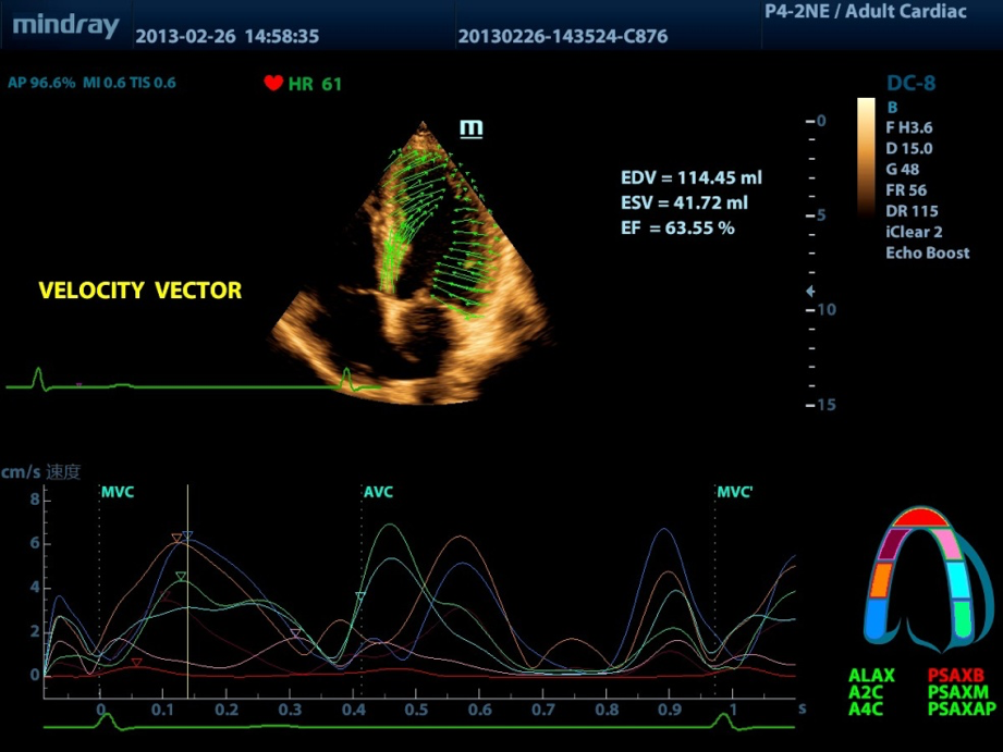 velocity.png velocity.png