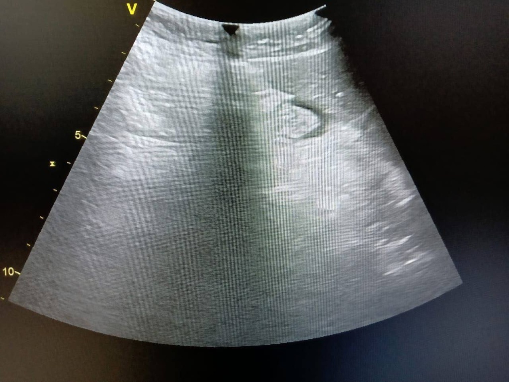 photo_2026-03-03_08-41-10.jpg photo_2026-03-03_08-41-10.jpg