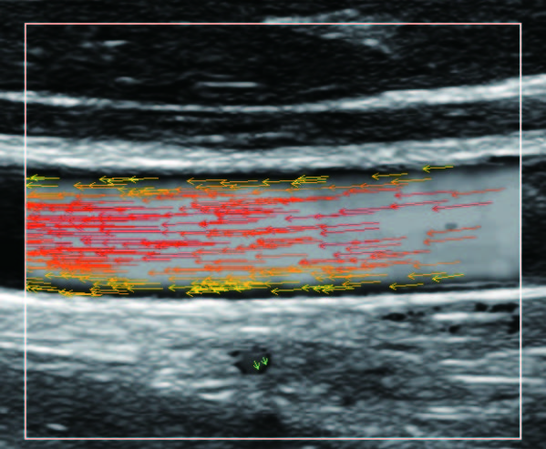 vflow_5_2.jpg vflow_5_2.jpg