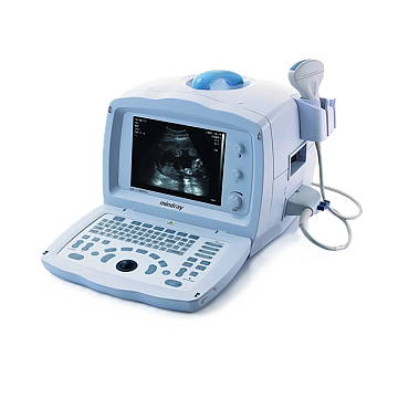 УЗИ аппарат Mindray DP 1100