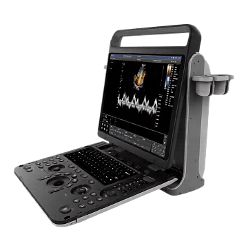 Портативный УЗИ аппарат Chison SonoTouch 60 Pro