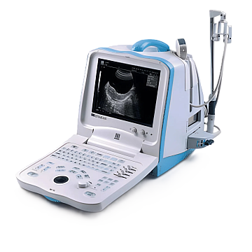 УЗИ аппарат Mindray DP 3300