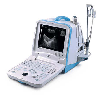 УЗИ аппарат Mindray DP 3300