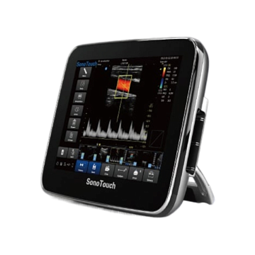 УЗИ аппарат CHISON SonoTouch 30 (ECO 3)