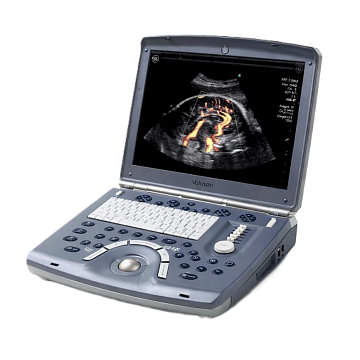 УЗИ аппарат GE Healthcare Voluson E