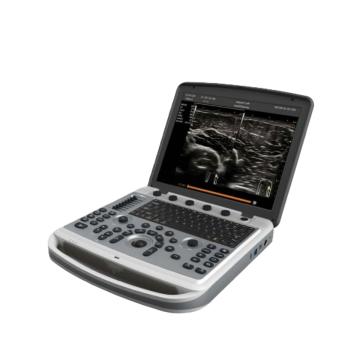 УЗИ аппарат Chison SonoTouch 80 (SonoBook 6)