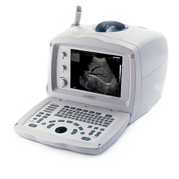 УЗИ аппарат Mindray DP 2200