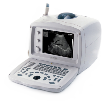 УЗИ аппарат Mindray DP 2200