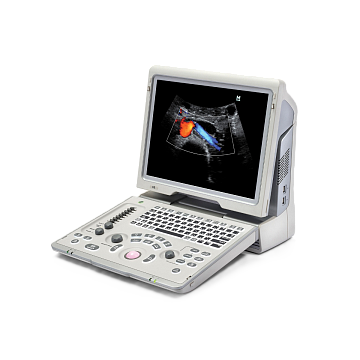 УЗИ аппарат Mindray Z6