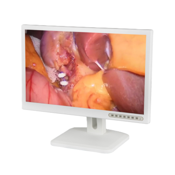 Монитор эндоскопический ОПТИMED 23,8"