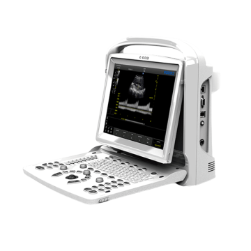 УЗИ аппарат CHISON ECO 3 Expert